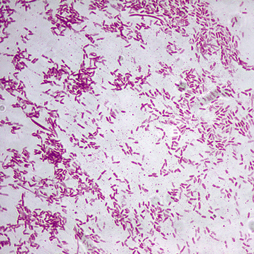 System'O di Aliaxis Italia protegge dalla pseudomonas fluorescens